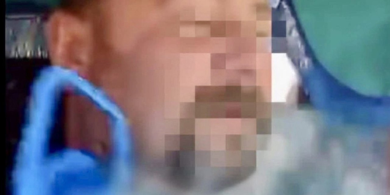 Afşin Belediye Binası Önünde Kendini Yaktı