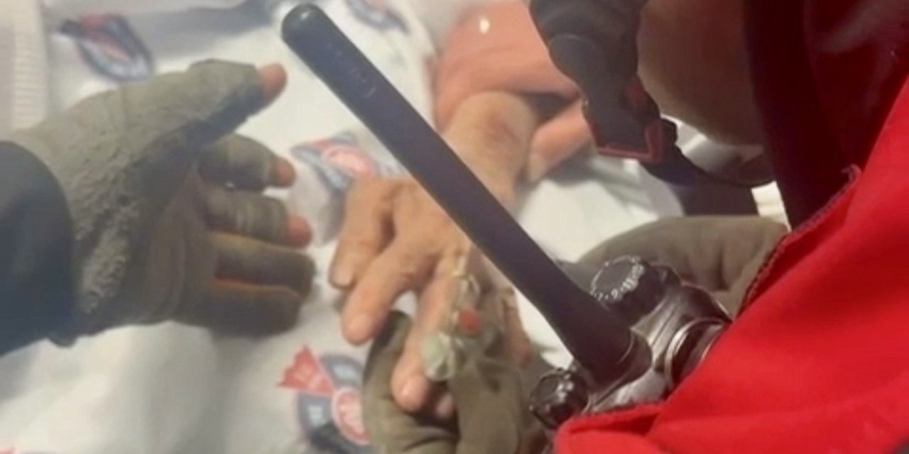 Kahramanmaraş’ta parmağına sıkışan yüzük itfaiye ekiplerince çıkarıldı