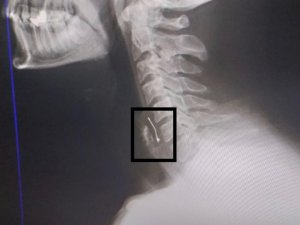 DOĞUM GÜNÜ PASTASI CANINA MAL OLUYORDU