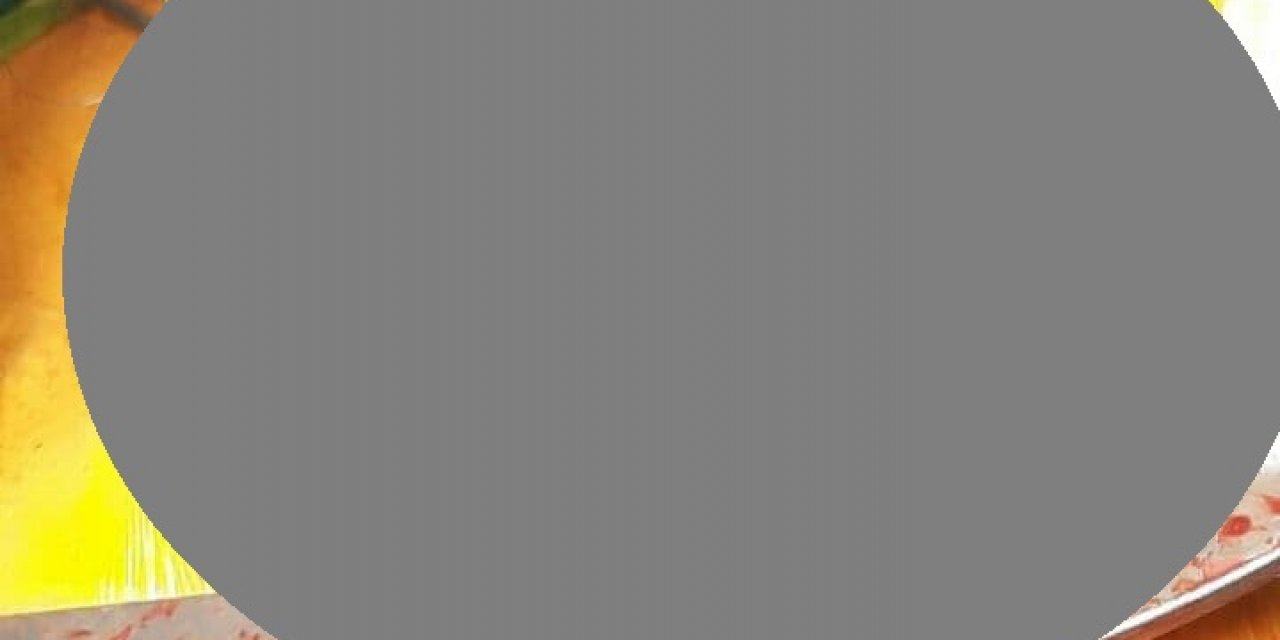 KSÜ Tıp Fakültesinde göğüs kafesi açılmadan ‘Koroner Bypass’ ameliyatı yapıldı